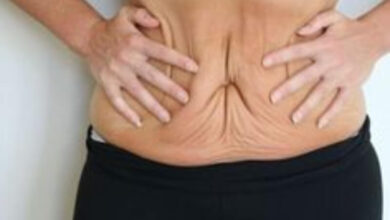 How Long Do Tummy Tuck Results Last