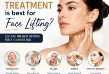 Which treatment is best for face lifting?