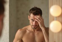 7 Ways to Choose a Hair Loss Treatment Worth Your Money in 2026